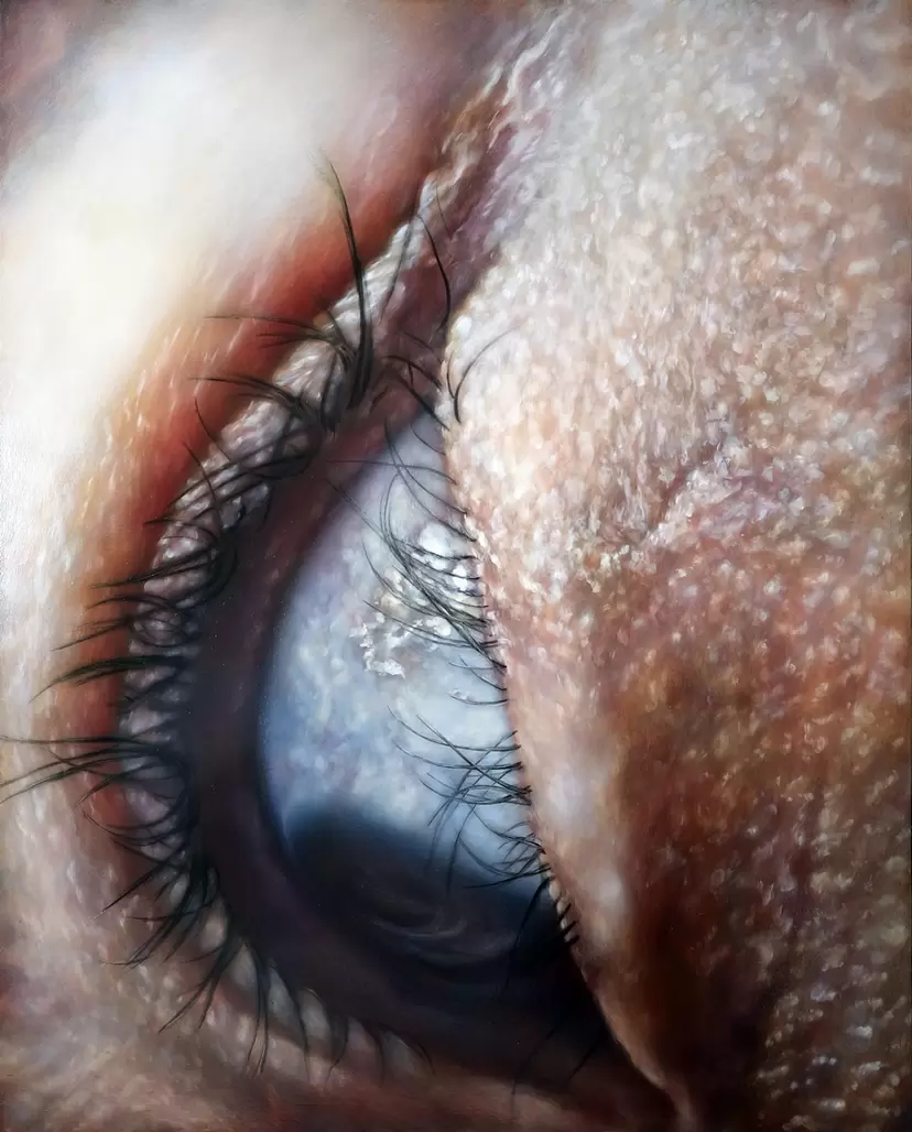 FACETS