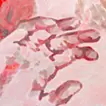穴