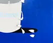 Mental bucket