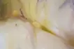 蛞蝓