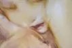 蛞蝓