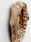 Vulva