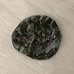 胃结石板 7