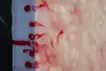SKIN L-1