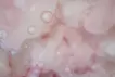 SKIN L-1