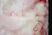 SKIN L-1