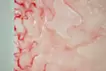 SKIN L-2