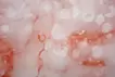SKIN  S-6