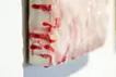 SKIN  S-9