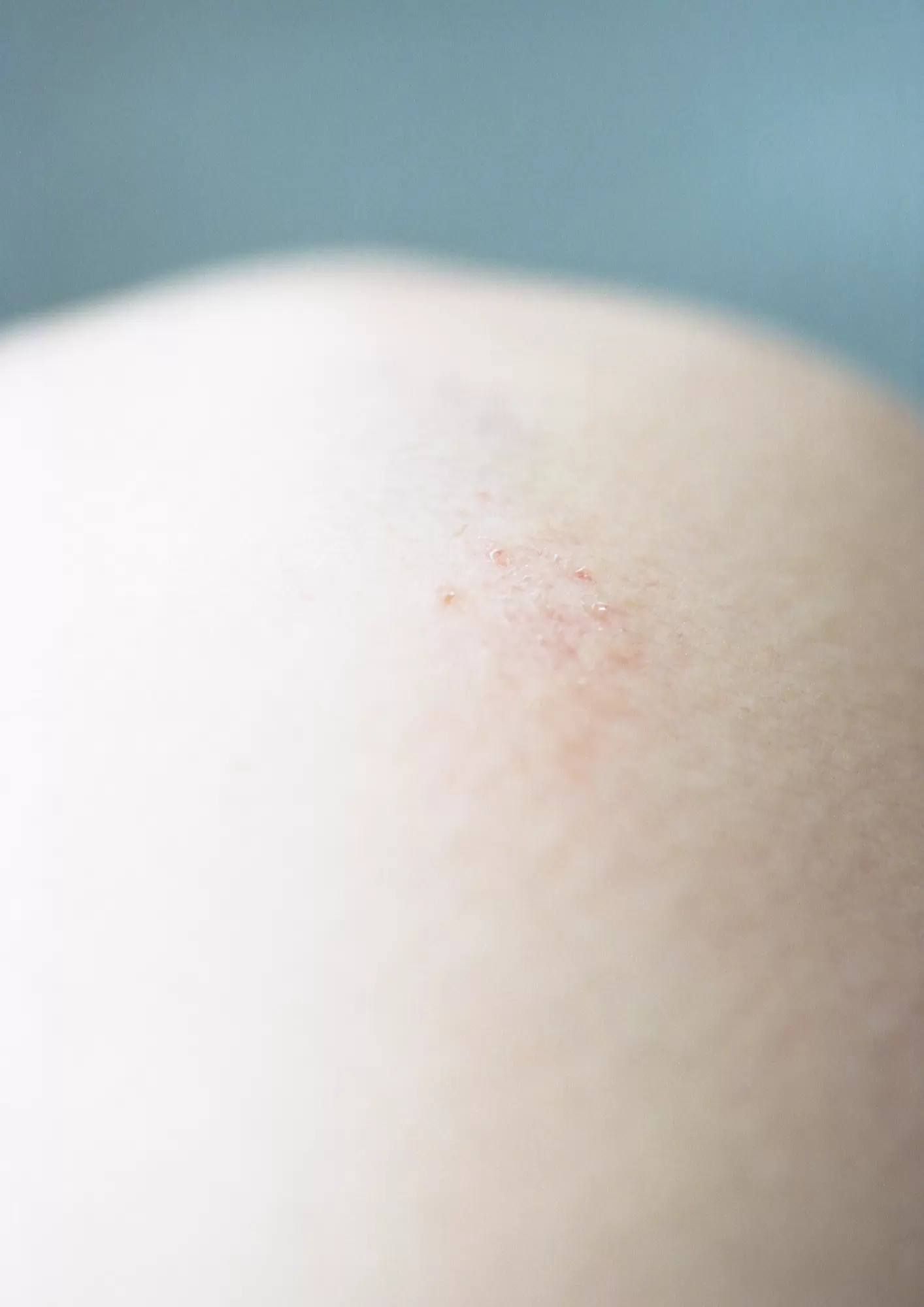 knee