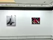 表層的な皮膚 / Superficial skin