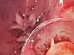 深層に何が映るのか - 不確かな世界 -